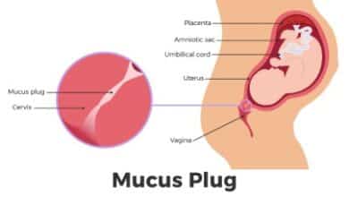 mucus plug