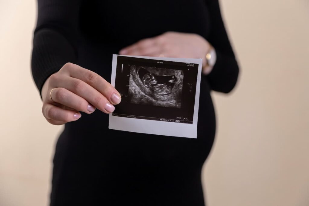 Lady Holding Pregnancy Scan Results